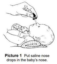 Put saline nose drops in the baby's nose.