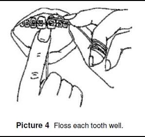 floss each tooth well
