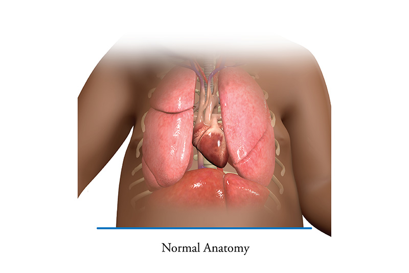 Normal Lung Anatomy
